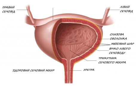 де зробити катетеризацію сечового міхура